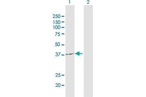 Western Blot analysis of KATNA1 expression in transfected 293T cell line by KATNA1 MaxPab polyclonal antibody.