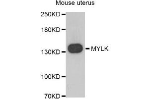 Western blot analysis of extracts of Mouse uterus, using MYLK antibody. (MYLK anticorps)