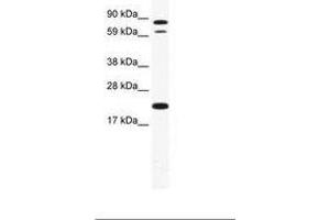 Image no. 1 for anti-Zinc Finger Protein 287 (ZNF287) (AA 104-153) antibody (ABIN202903) (ZNF287 anticorps  (AA 104-153))