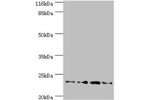 Western blot All lanes: Fxn antibody at 2 μg/mL Lane 1: HepG2 whole cell lysate Lane 2: Hela whole cell lysate Lane 3: Mouse brain tissue Lane 4: Jurkat whole cell lysate Secondary Goat polyclonal to rabbit IgG at 1/10000 dilution Predicted band size: 23 kDa Observed band size: 23 kDa (Frataxin anticorps  (AA 78-207))