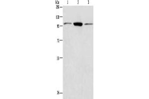 Gel: 8 % SDS-PAGE, Lysate: 40 μg, Lane 1-3: Hela cells, Jurkat cells, NIH/3T3 cells, Primary antibody: ABIN7128400(ANAPC2 Antibody) at dilution 1/200, Secondary antibody: Goat anti rabbit IgG at 1/8000 dilution, Exposure time: 40 seconds (ANAPC2 anticorps)