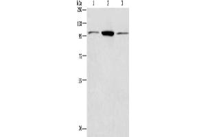 Gel: 8 % SDS-PAGE, Lysate: 40 μg, Lane 1-3: Hela cells, Jurkat cells, NIH/3T3 cells, Primary antibody: ABIN7128400(ANAPC2 Antibody) at dilution 1/200, Secondary antibody: Goat anti rabbit IgG at 1/8000 dilution, Exposure time: 40 seconds