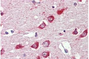 anti-gamma-aminobutyric Acid (GABA) A Receptor, alpha 3 (GABRA3) (AA 480-492) antibody