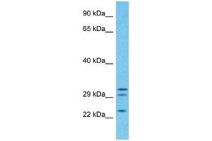 Host:  Rabbit  Target Name:  PGRC2  Sample Type:  Fetal Lung lysates  Antibody Dilution:  1ug/ml (PGRMC1 anticorps  (C-Term))