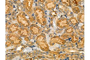 ABIN6257018 and ABIN6274200 at 1/100 staining Rat kidney tissue by IHC-P. (PRKACG anticorps  (N-Term))
