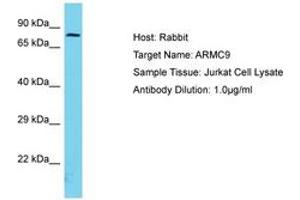 Image no. 1 for anti-Armadillo Repeat Containing 9 (ARMC9) (AA 90-139) antibody (ABIN6750691) (ARMC9 anticorps  (AA 90-139))