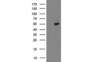 Western Blotting (WB) image for anti-ATPase, H+ Transporting, Lysosomal 56/58kDa, V1 Subunit B1 (ATP6V1B1) antibody (ABIN1496774) (ATP6V1B1 anticorps)