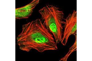 Immunofluorescence analysis of HeLa cells using CEBPA mouse mAb (green).