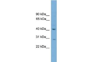 WB Suggested Anti-HAPLN4 Antibody Titration:  0. (HAPLN4 anticorps  (C-Term))