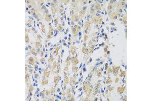 Immunohistochemistry of paraffin-embedded human stomach using VPS4A antibody at dilution of 1:100 (40x lens). (VPS4A anticorps)