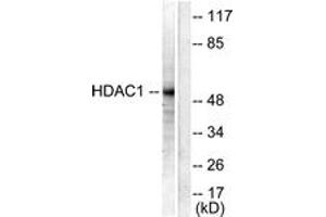 Western blot analysis of extracts from NIH-3T3 cells, using HDAC1 Antibody. (HDAC1 anticorps  (AA 433-482))