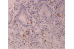 anti-Filaggrin Family Member 2 (FLG2) (AA 1222-1368) antibody