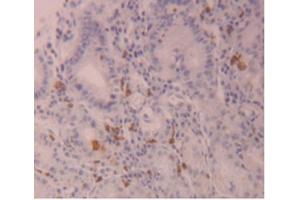 IHC-P analysis of Human Stomach Tissue, with DAB staining. (FLG2 anticorps  (AA 1222-1368))