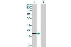 Lane 1: UBE2G1 transfected lysate ( 18.
