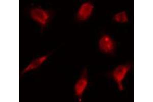 ABIN6274179 staining HeLa cells by IF/ICC. (ZNF18 anticorps  (C-Term))