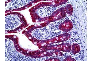 Anti-Cytokeratin Type II antibody IHC of human intestine. (Keratin Basic anticorps)