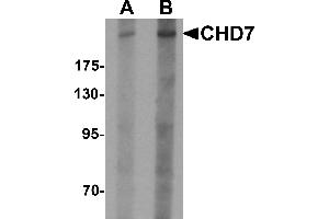 Western blot analysis of CHD7 in SK-N-SH cell lysate with CHD7 antibody at (A) 1 and (B) 2 µg/mL. (CHD7 anticorps  (N-Term))