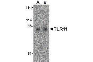 Western Blotting (WB) image for anti-Toll-Like Receptor 11 (Tlr11) (C-Term) antibody (ABIN2476846)