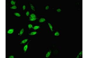 Immunofluorescent analysis of Hela cells using ABIN7173949 at dilution of 1:100 and Alexa Fluor 488-congugated AffiniPure Goat Anti-Rabbit IgG(H+L)