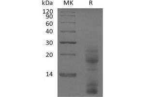 Western Blotting (WB) image for Thymic Stromal Lymphopoietin (TSLP) (Active) protein (His tag) (ABIN7319801)