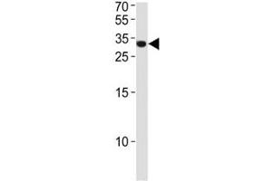 ASCL1 antibody western blot analysis in NCI-H460 lysate.