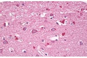 Image no. 2 for anti-Ras Homolog Family Member G (RHOG) (AA 112-161) antibody (ABIN6749774)