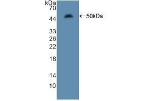 Detection of Recombinant MAP4, Rat using Polyclonal Antibody to Microtubule Associated Protein 4 (MAP4)