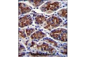 EPHX3 Antibody (C-term) (ABIN655588 and ABIN2845075) immunohistochemistry analysis in formalin fixed and paraffin embedded human stomach tissue followed by peroxidase conjugation of the secondary antibody and DAB staining. (ABHD9 anticorps  (C-Term))