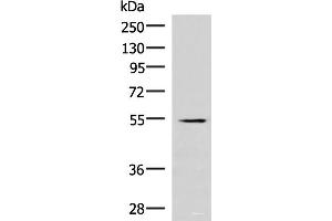 Western blot analysis of Human heart tissue lysate using IRX1 Polyclonal Antibody at dilution of 1:300 (IRX1 anticorps)