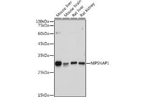 Western blot analysis of extracts of various cell lines, using NIPSN antibody (ABIN7265337) at 1:1000 dilution. (NIPSNAP1 anticorps)