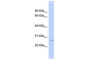 Image no. 1 for anti-Glutathione S-Transferase pi 1 (GSTP1) (AA 35-84) antibody (ABIN6743477) (GSTP1 anticorps  (AA 35-84))