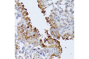 Immunohistochemistry of paraffin-embedded mouse lung using Septin 4 antibody (ABIN6128476, ABIN6147554, ABIN6147555 and ABIN6214410) at dilution of 1:100 (40x lens).