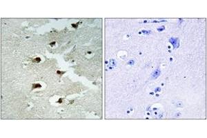Immunohistochemistry analysis of paraffin-embedded human brain tissue, using CDCA4 Antibody. (CDCA4 anticorps  (AA 121-170))