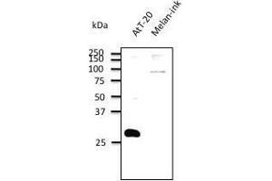 Anti. (RAB27B anticorps  (C-Term))