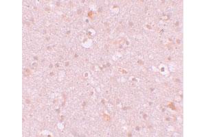 Immunohistochemical staining of human brain cells with CXXC4 polyclonal antibody  at 10 ug/mL.