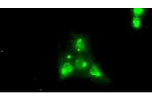 Image no. 2 for anti-Neurotrophic tyrosine Kinase, Receptor, Type 3 (NTRK3) antibody (ABIN1499841) (NTRK3 anticorps)