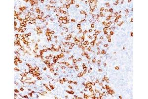 IHC testing of human tonsil (20X) stained with CD8a antibody (C8/468). (CD8 alpha anticorps)