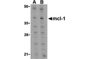 Western Blotting (WB) image for anti-Induced Myeloid Leukemia Cell Differentiation Protein Mcl-1 (MCL1) (C-Term) antibody (ABIN1030511) (MCL-1 anticorps  (C-Term))