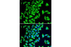 Immunofluorescence analysis of A549 cells using TPH2 antibody. (Tryptophan Hydroxylase 2 anticorps)