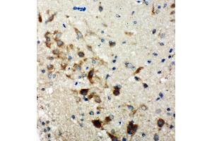 Anti-Hamartin antibody, IHC(P) IHC(P): Rat Brain Tissue (TSC1 anticorps  (C-Term))