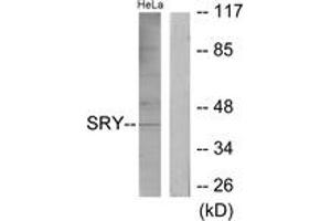 Western blot analysis of extracts from HeLa cells, using SRY Antibody. (SRY anticorps  (AA 51-100))