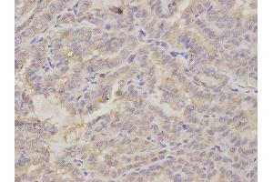 Immunohistochemistry (IHC) image for anti-Golgin A2 (GOLGA2) antibody (ABIN1876532) (Golgin A2 (GOLGA2) anticorps)