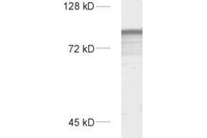 SYNPO anticorps  (Isoform 2)