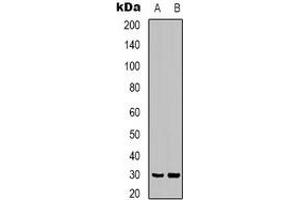 Western blot analysis of CLIC4 expression in mouse brain (A), rat brain (B) whole cell lysates. (CLIC4 anticorps)