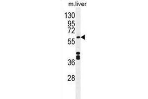 Western Blotting (WB) image for anti-Cytochrome P450, Family 1, Subfamily A, Polypeptide 2 (CYP1A2) antibody (ABIN2996139) (CYP1A2 anticorps)