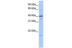 Image no. 1 for anti-Tubulin Polymerization-Promoting Protein Family Member 3 (TPPP3) (C-Term) antibody (ABIN6740766) (TPPP3 anticorps  (C-Term))