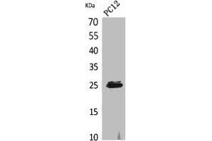 Western Blot analysis of PC12 cells using CMTM5 Polyclonal Antibody.