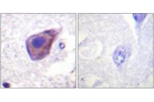 Immunohistochemistry (IHC) image for anti-Guanine Nucleotide Binding Protein (G Protein), alpha Z Polypeptide (GNaZ) (AA 1-50) antibody (ABIN2888875)