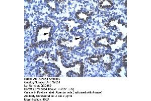 Human Lung (APEX1 anticorps  (N-Term))