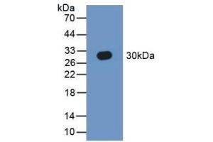 Detection of Recombinant SEPT5, Human using Polyclonal Antibody to Septin 5 (SEPT5)